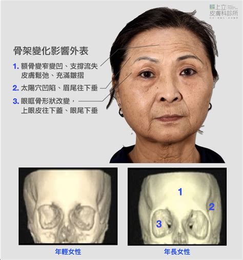 額頭有凹|「額頭塌、眼尾垂、夫妻宮凹」看起來好命苦！該怎麼。